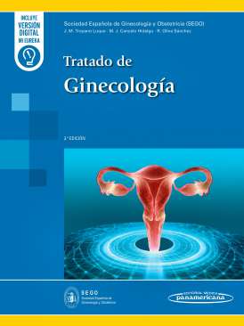 Tratado de ginecolog�a