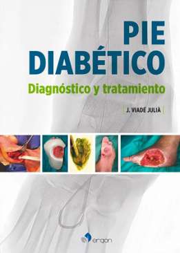 Pie diab�tico