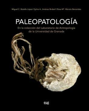 Paleopatolog�a en la colecci�n del laboratorio de Antropolog�a de la Universidad de Granada