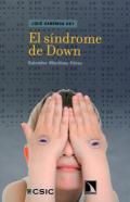 El s�ndrome de Down