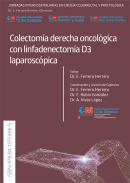 Colectom�a derecha oncol�gica con linfadenectom�a D3 laparosc�pica