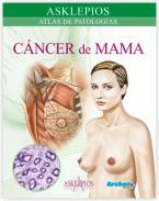 Atlas de c�ncer de mama