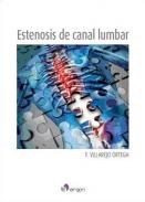 Estenosis de canal lumbar