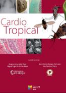 Cardio tropical