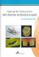 Manual de restauraci�n del diente endodonciado