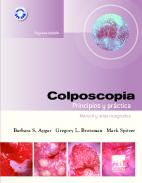 Colposcopia