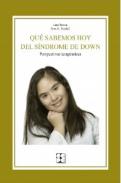 Qu� sabemos hoy del S�ndrome de Down