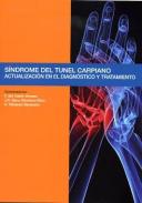 S�ndrome del tunel carpiano