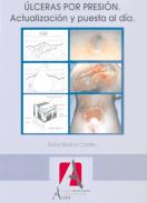 �lceras por presi�n