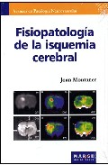 Fisiopatolog�a de la isquemia cerebral