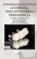 Monograf�as cient�ficas en cirug�a, implantolog�a y periodoncia