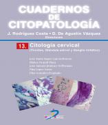 Citolog�a cervical
