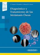 Diagn�stico y tratamiento de las met�stasis �seas