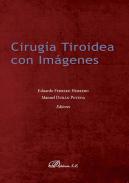 Cirug�a tiroidea con im�genes