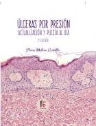 �lceras por presi�n
