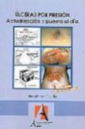 �lceras por presi�n
