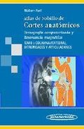 Atlas de bolsillo de cortes anat�micos : 

tomograf�a computerizada y resonancia magn�tica, 3