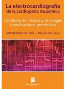 La electro cardiograf�a de la cardiopat�a isqu�mica