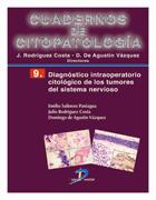 Di�gn�stico intraoperatorio citol�gico de los tumores del sistema nervioso