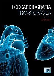 Ecocardiografia transtor�cica